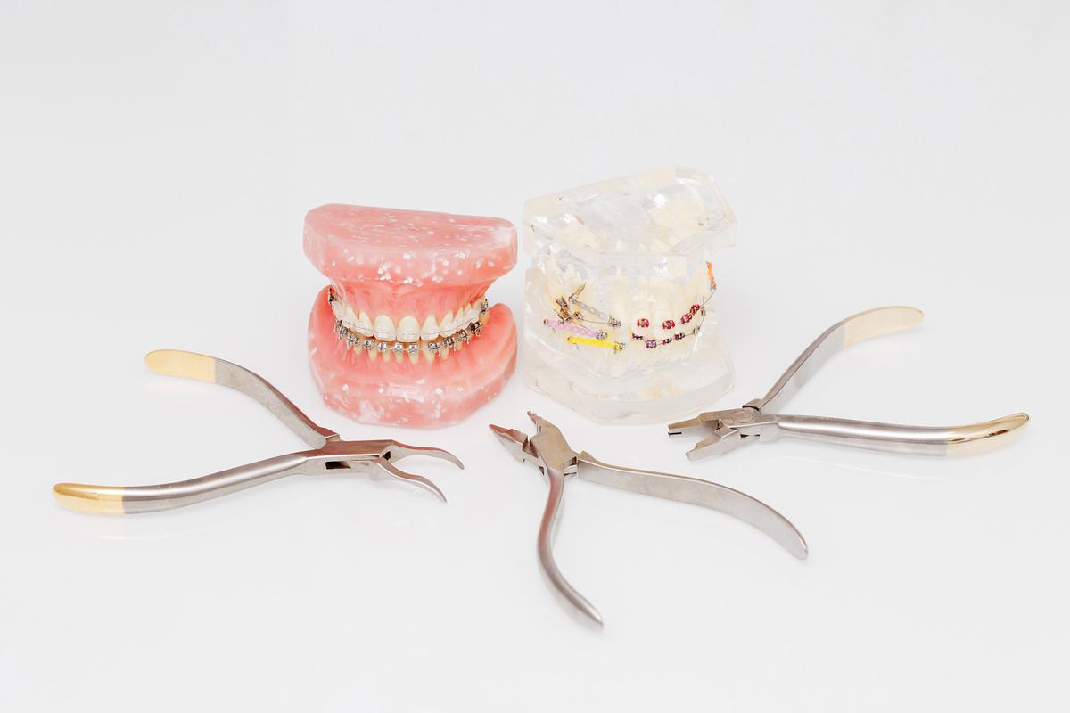 牙齿正畸添加的零件-图2 牙齿正畸添加的零件-图2