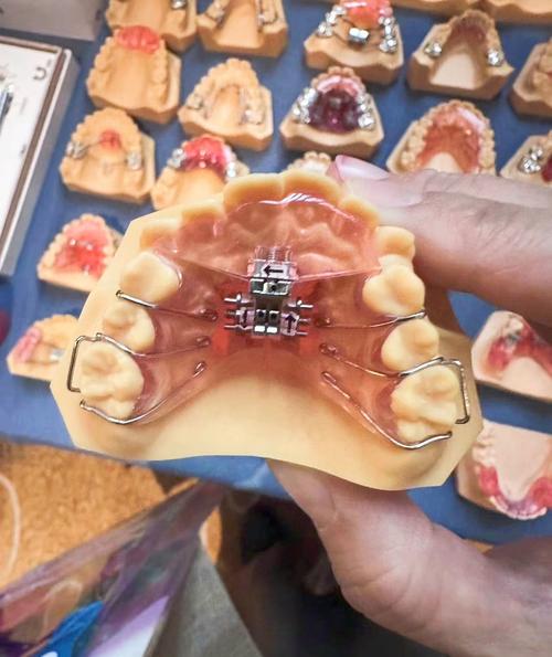 正畸垂直开大曲弯制-图2