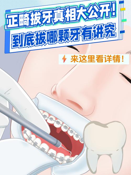 正畸拔7号牙会影响矫正效果吗？-图3