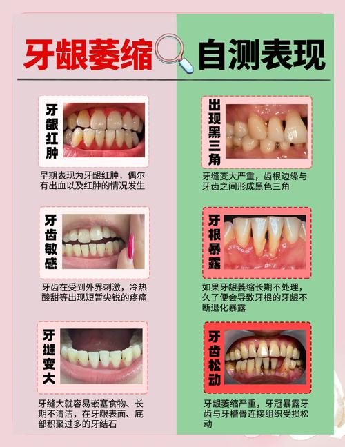 牙周不好不能正畸吗-图1