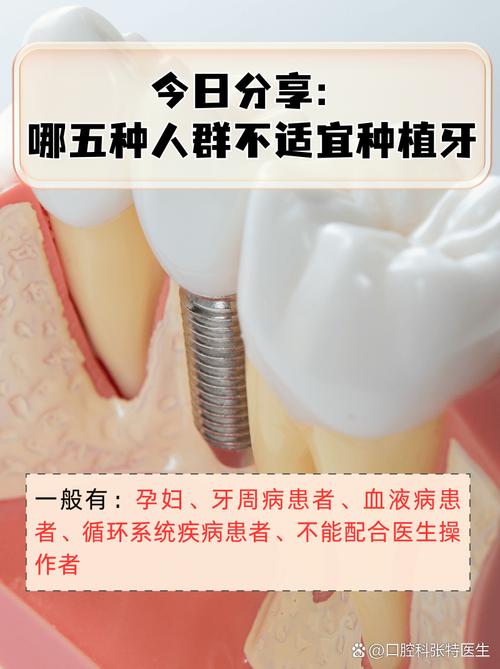 不种牙比种牙强-图1 不种牙比种牙强-图1