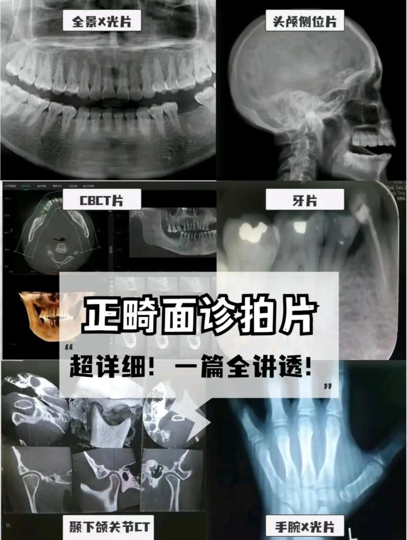 正畸拍什么片多少钱-图1