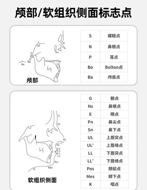 正畸头侧位影像中Z点该如何精准定位?-图2 正畸头侧位影像中Z点该如何精准定位?-图2