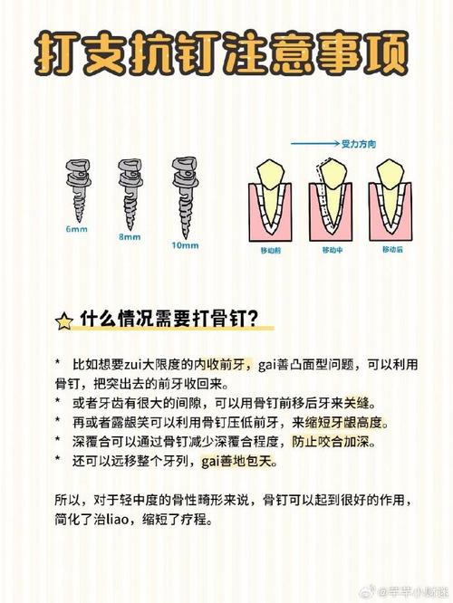 正畸支抗钉的发展史-图1