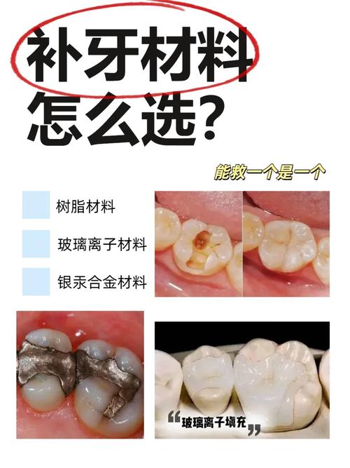 种牙和补牙区别-图1 种牙和补牙区别-图1