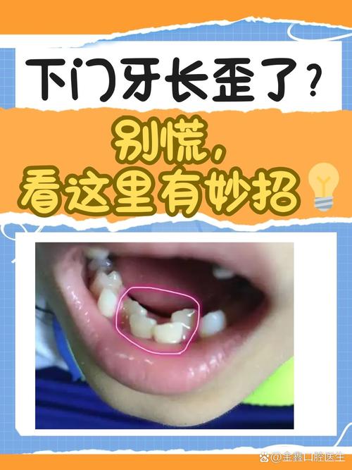 种牙歪了怎么办-图1 种牙歪了怎么办-图1