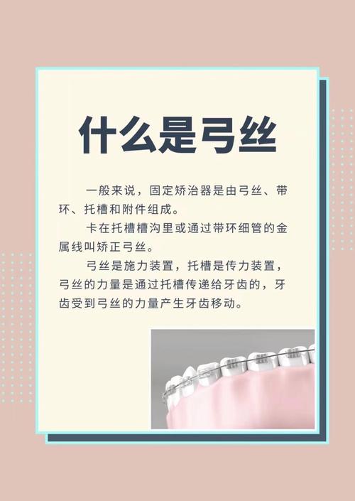 正畸不锈钢弓丝图谱，如何解析弓丝选择与矫治技巧？-图2