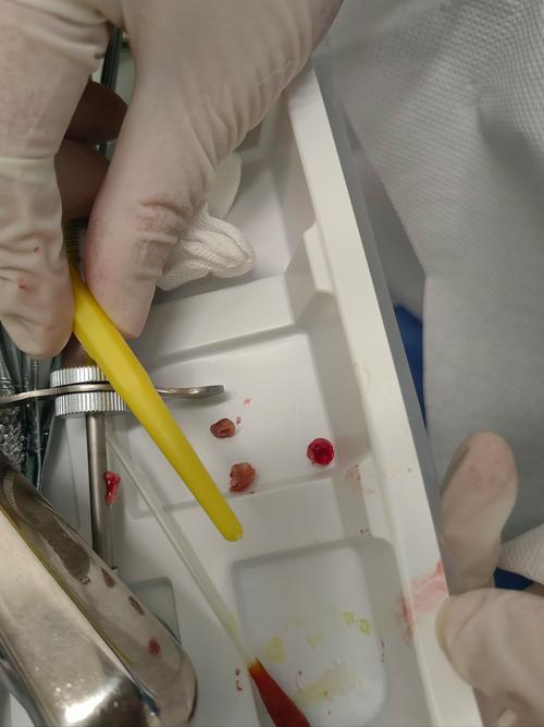 种牙过敏怎么办-图3 种牙过敏怎么办-图3