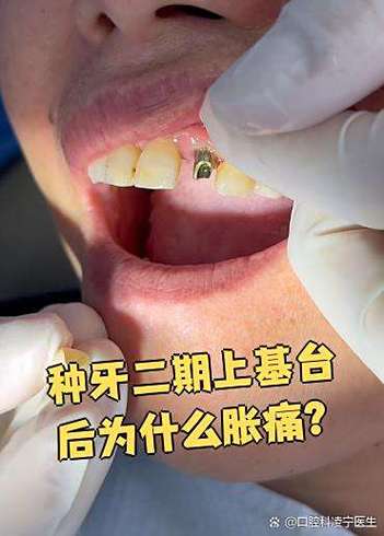 种牙打麻药疼吗-图3