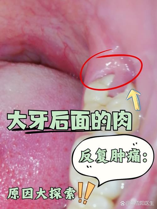种牙后肿胀一般几天能消？-图2