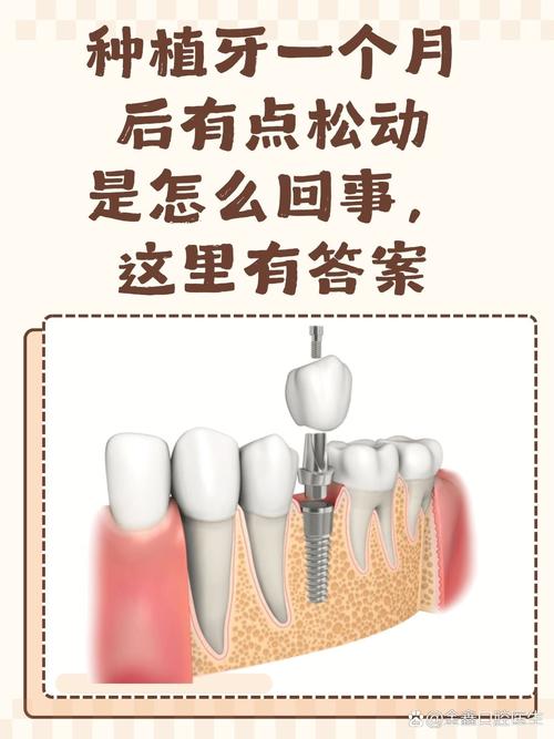种牙后会痛几天-图3