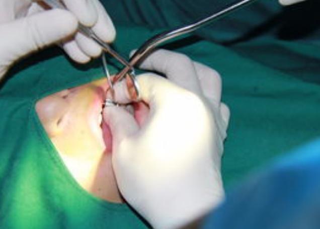 南京哪里种牙好？靠谱牙科机构怎么选？-图3