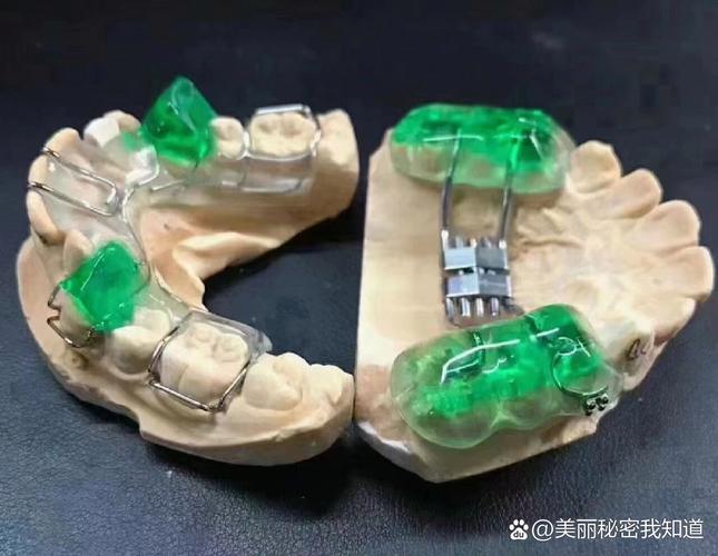 美国正畸矫治器公司-图3 美国正畸矫治器公司-图3