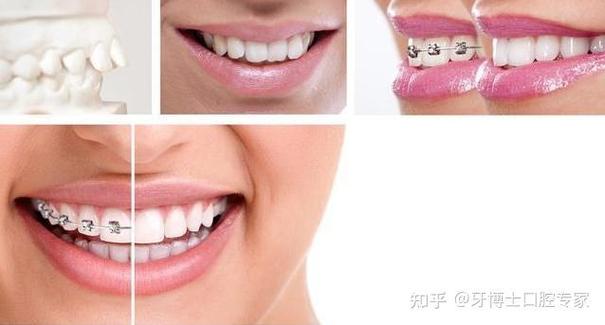 北大口腔研究生正畸-图3