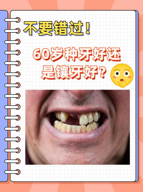60岁能种牙吗？高龄种植牙攻略全解析-图3