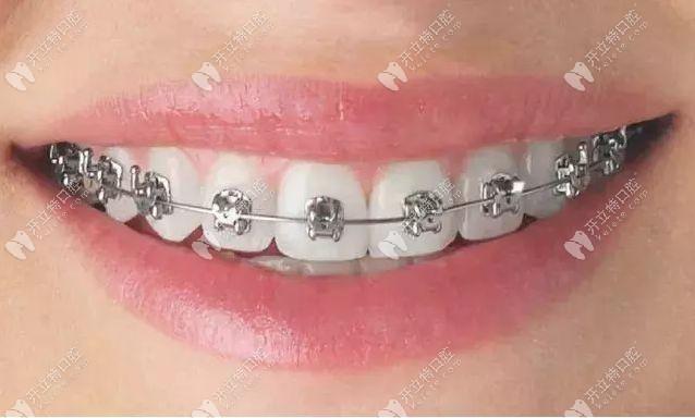 西安圣贝正畸怎么样-图2