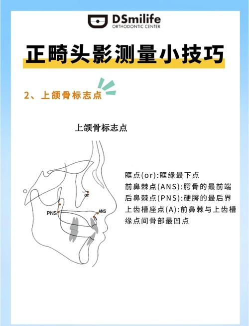 没有头影测量的情况下进行正畸，真的靠谱吗？-图2
