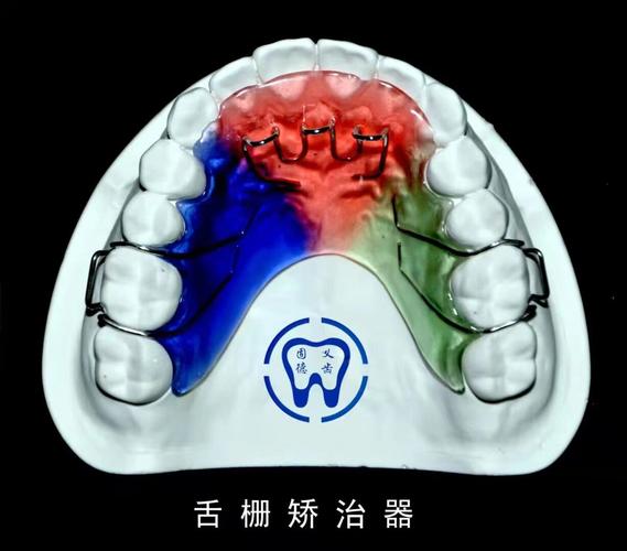 正畸的拉簧在尖牙上-图3