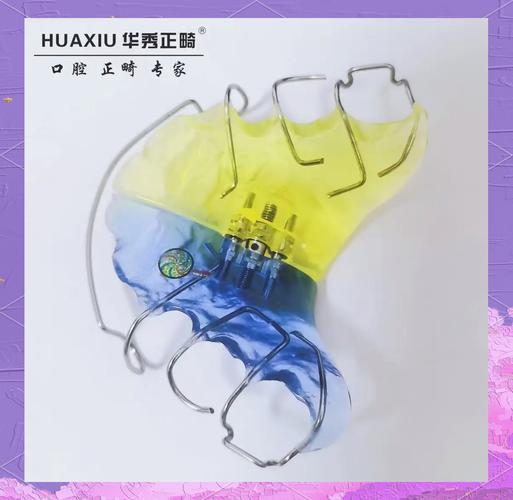 正畸螺旋扩弓器英文-图1