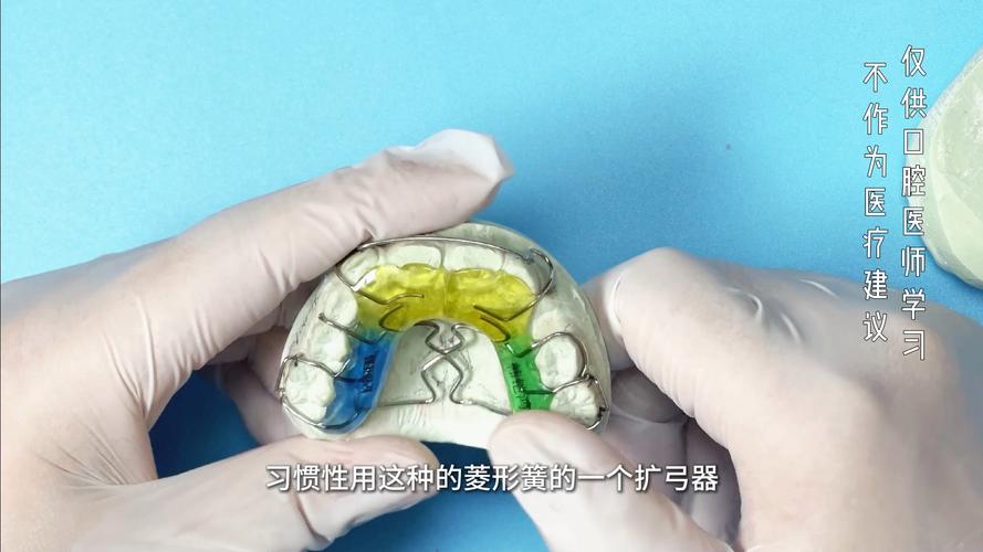 牙齿正畸口腔扩充器-图1