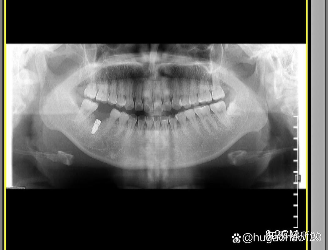浙江省口腔种牙-图2