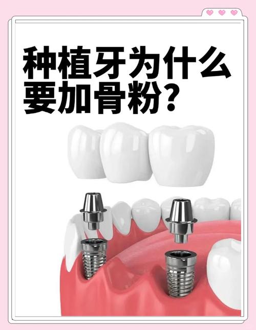 种牙骨粉是什么-图3