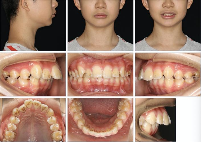 欧洲口腔正畸学杂志聚焦哪些前沿临床与研究问题？-图3