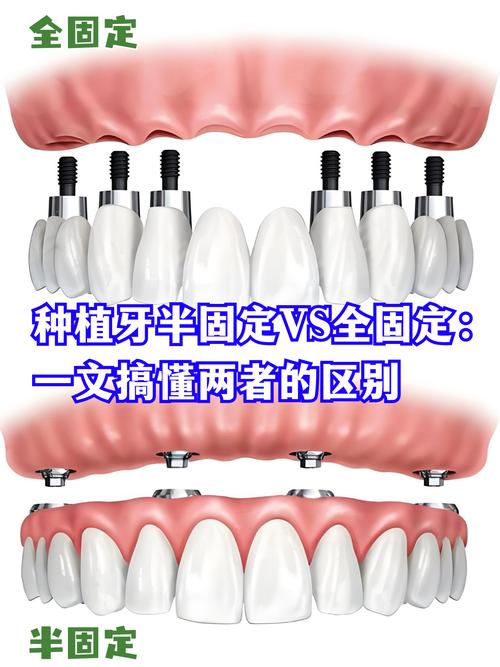 种牙选韩国还是德国？技术、价格、效果怎么比？-图2