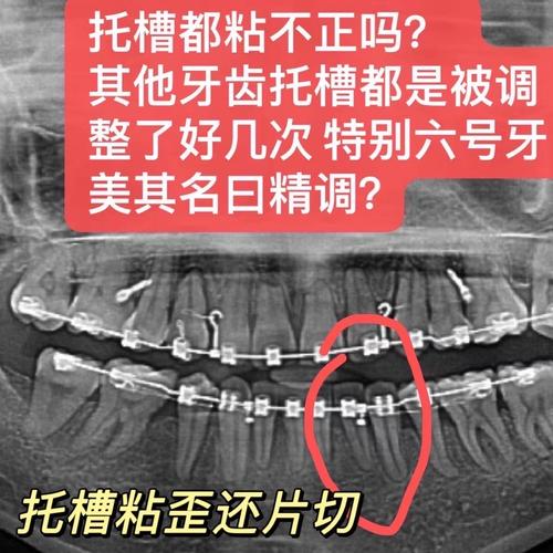 正畸拍X光有辐射吗？安全吗？-图2