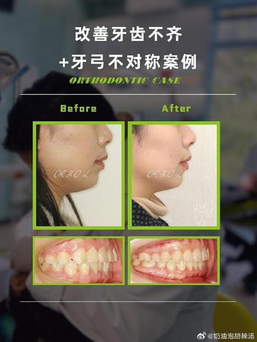 北京王府井口腔正畸-图1