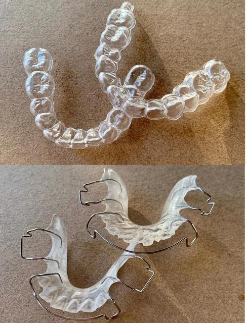 正畸保持器图片大全-图2