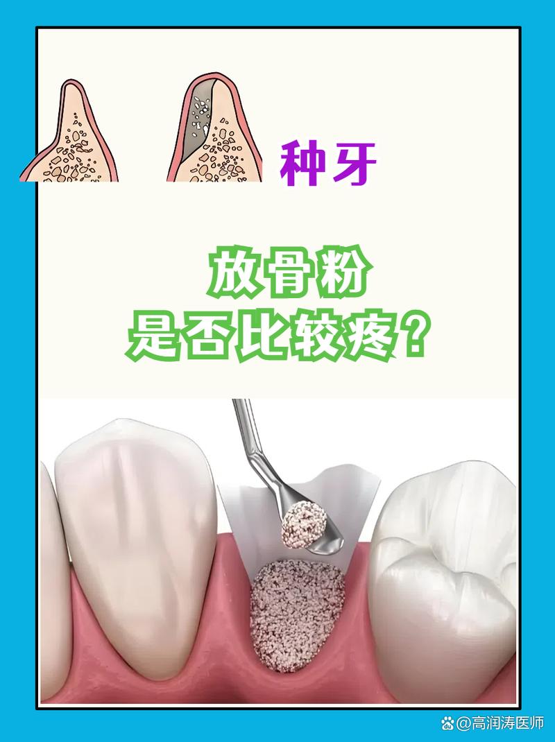 种牙放骨粉疼吗？操作过程会有多痛苦？-图1