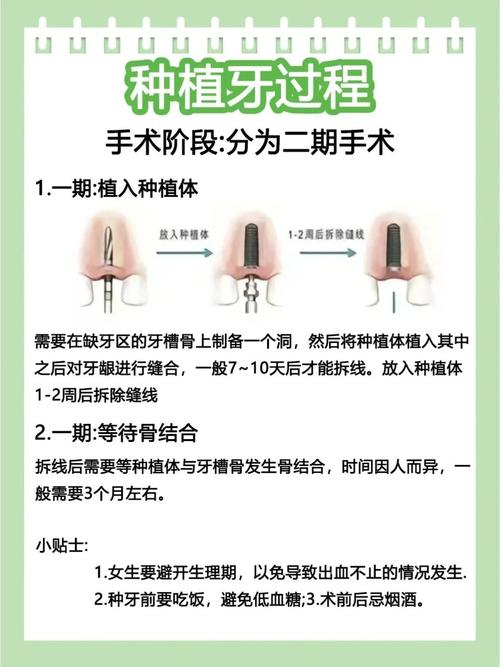 微创种牙危险吗-图1