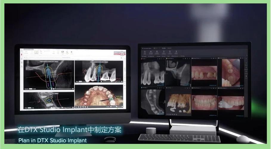 种牙系统有哪些-图1 种牙系统有哪些-图1
