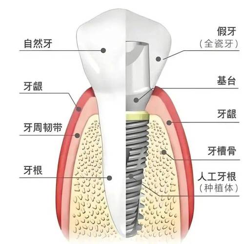 种牙系统有哪些-图2 种牙系统有哪些-图2