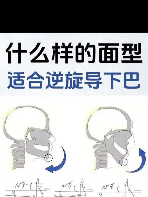 正畸逆时针旋转下巴-图1 正畸逆时针旋转下巴-图1