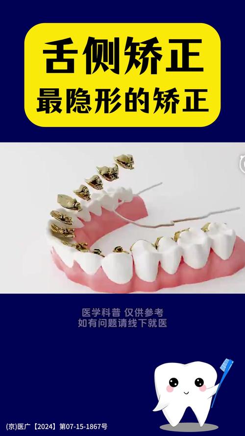 正畸中如何有效防止前牙舌倾？-图3