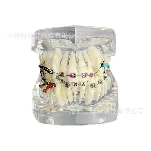 正畸牙模一般多少钱？-图2