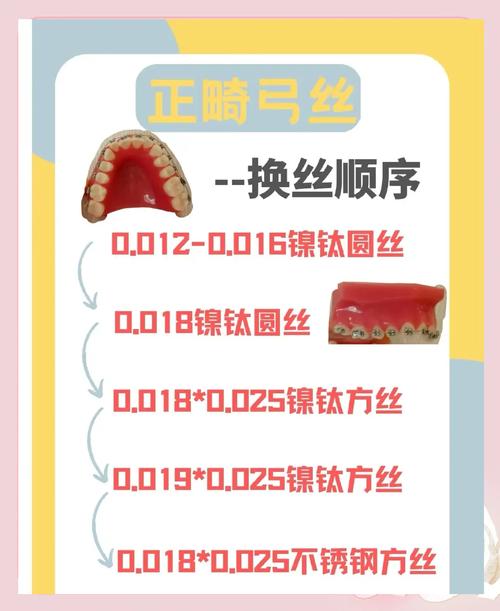 正畸 防止弓丝串位-图1