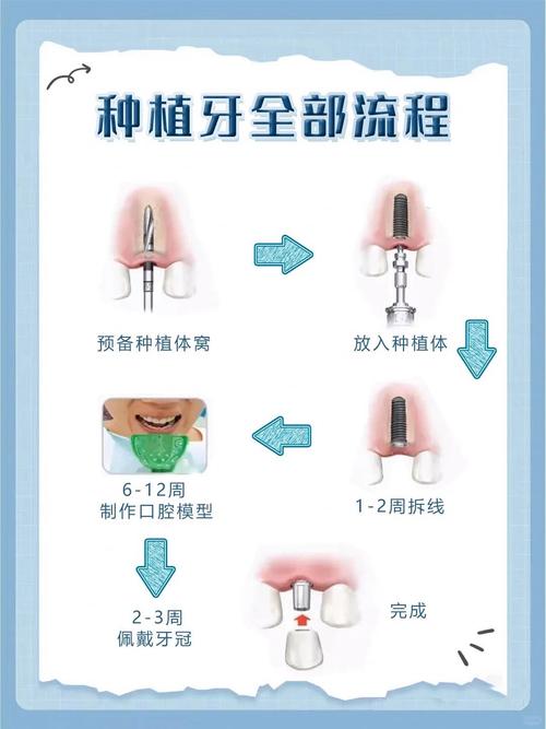 多久？全过程时间周期详解-图1