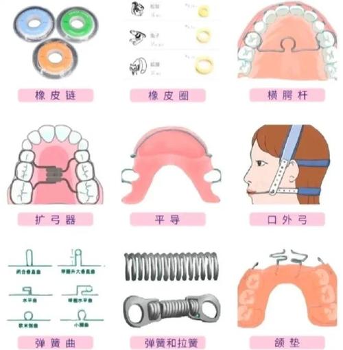 正畸为什么要戴斜导？它对牙齿矫正有何关键作用？-图3