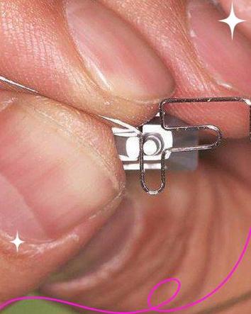 正畸主弓丝成型方法的关键步骤是什么？-图1