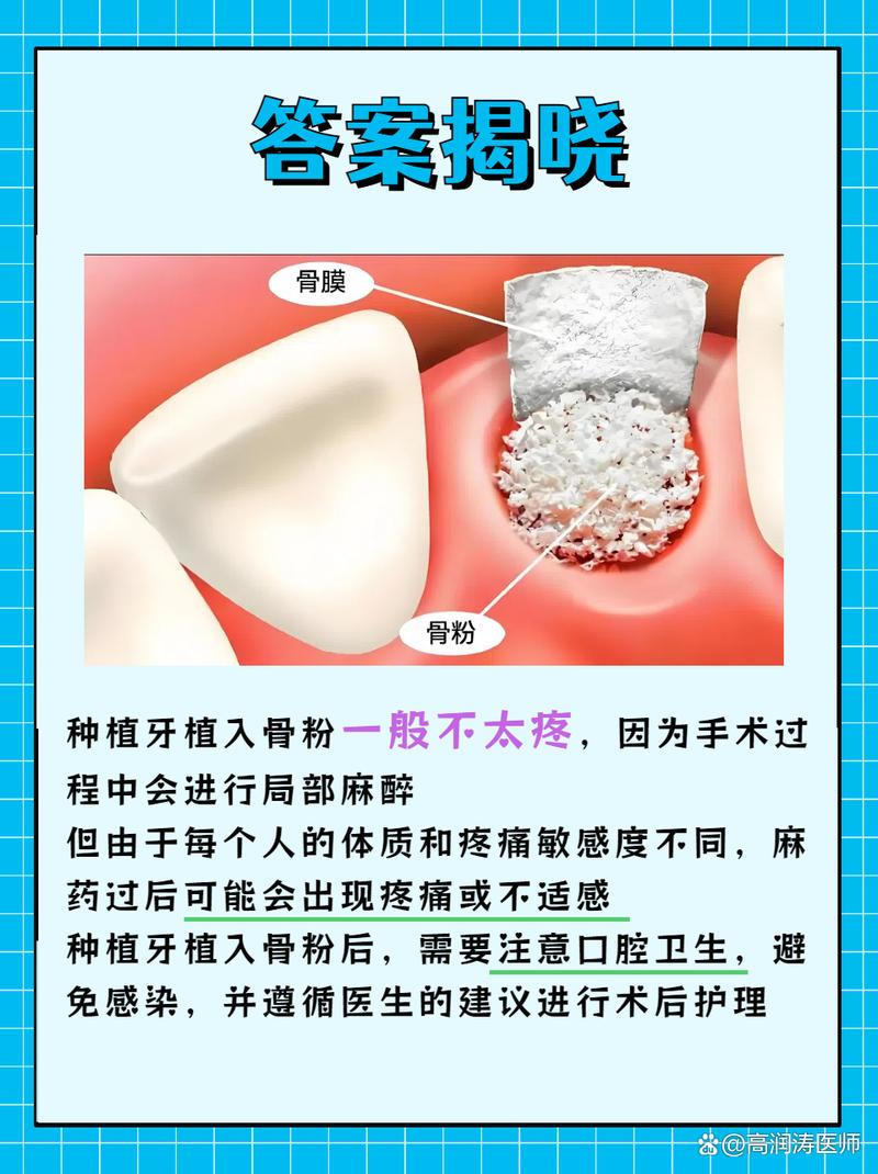 种牙需要骨粉吗-图2