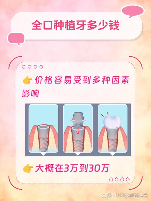 种满口牙费用多少？价格受哪些因素影响？-图2