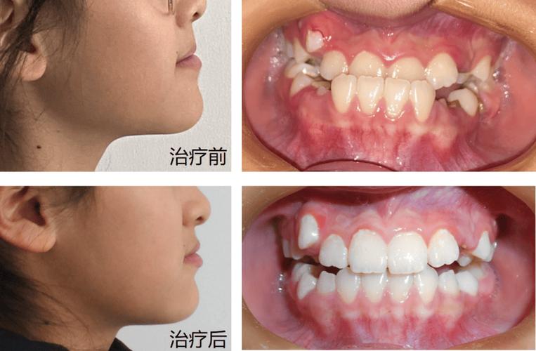 口腔正畸课免费视频-图3