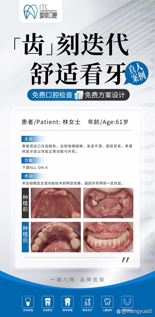 on6种植牙-图2 on6种植牙-图2