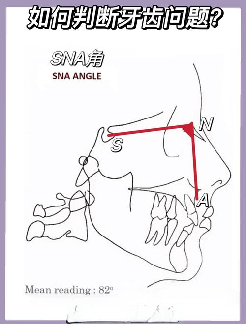 正畸侧位片测量数据-图2