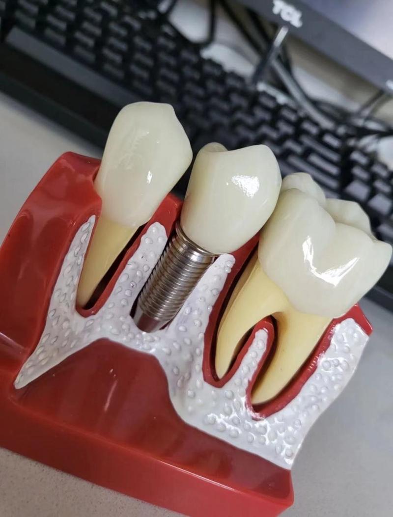 种牙是什样的-图2