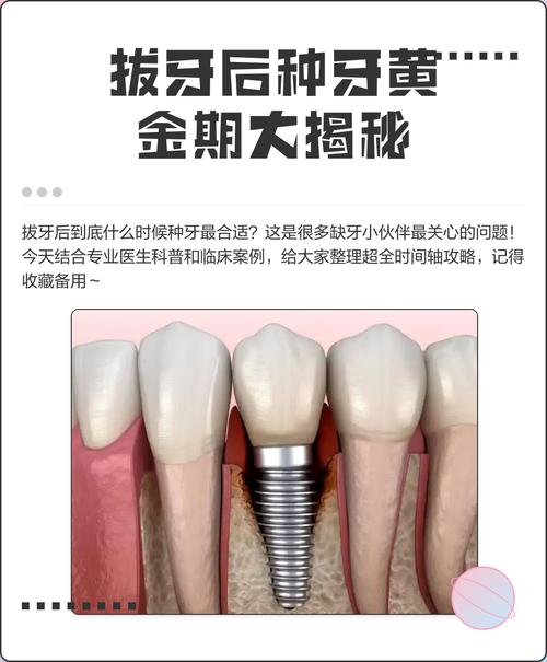 种牙用拔牙不-图2