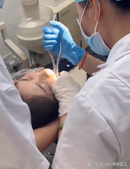 种牙用拔牙不-图3